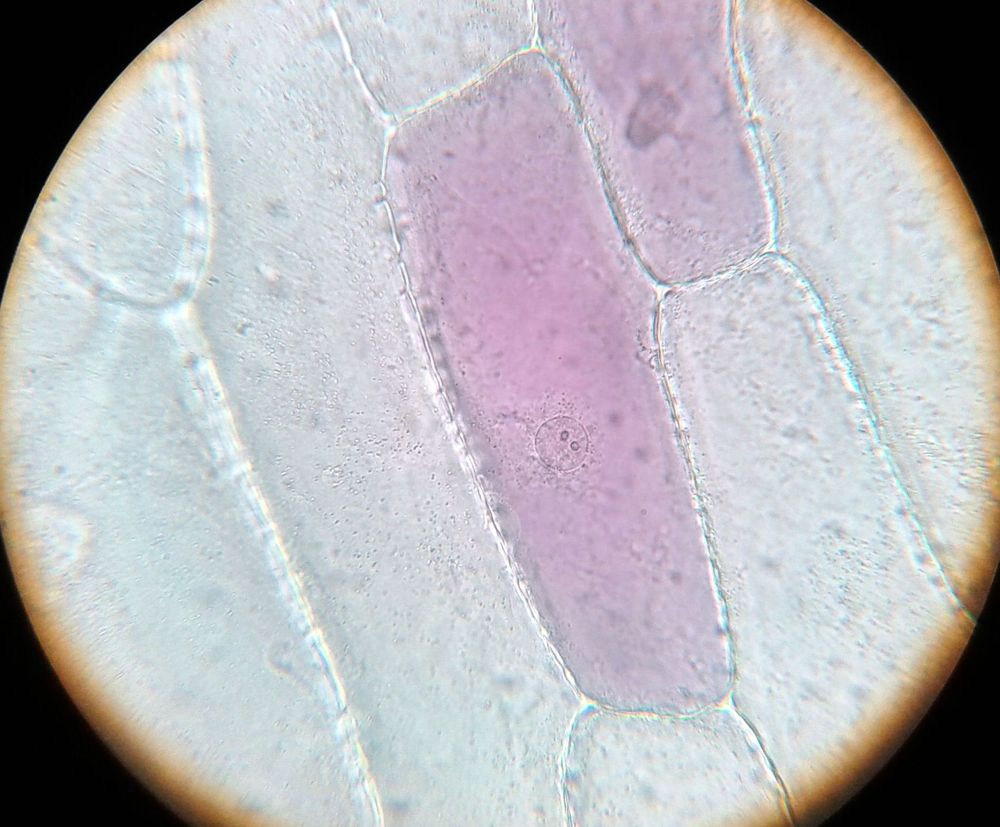 Observation Microscopique De Cellules Vegetales Les Eyquems